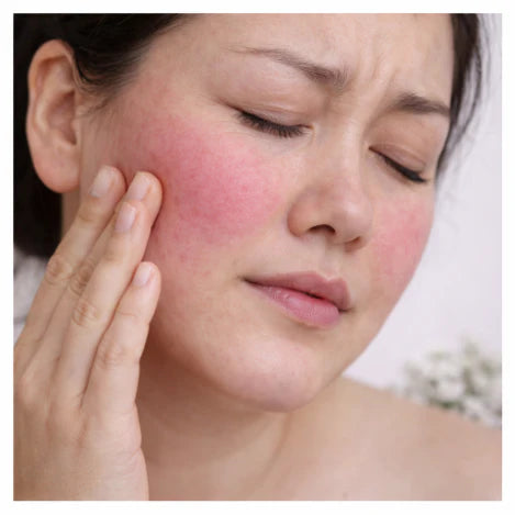 Peau sensible ou réactive